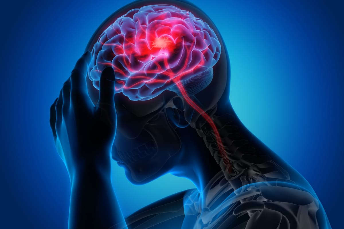 The signs and symptoms of stroke