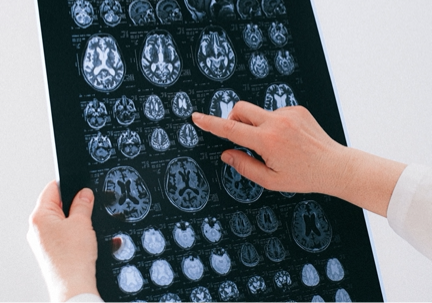 How to improve the brain health of seniors