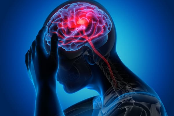 The signs and symptoms of stroke