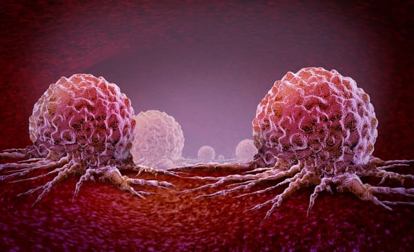 An overview of ovarian and prostate cancer